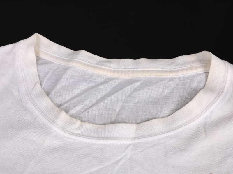 ナース服の黄ばみ汚れを落とす方法 制服の襟裏に多い黄ばみの原因と上手な汚れ落としのコツとは